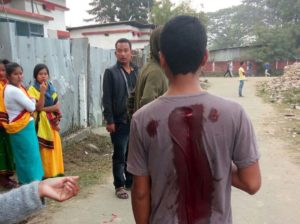 A youth who was injured in the police firing.