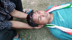 One of the injured in the police firing at Maibang.