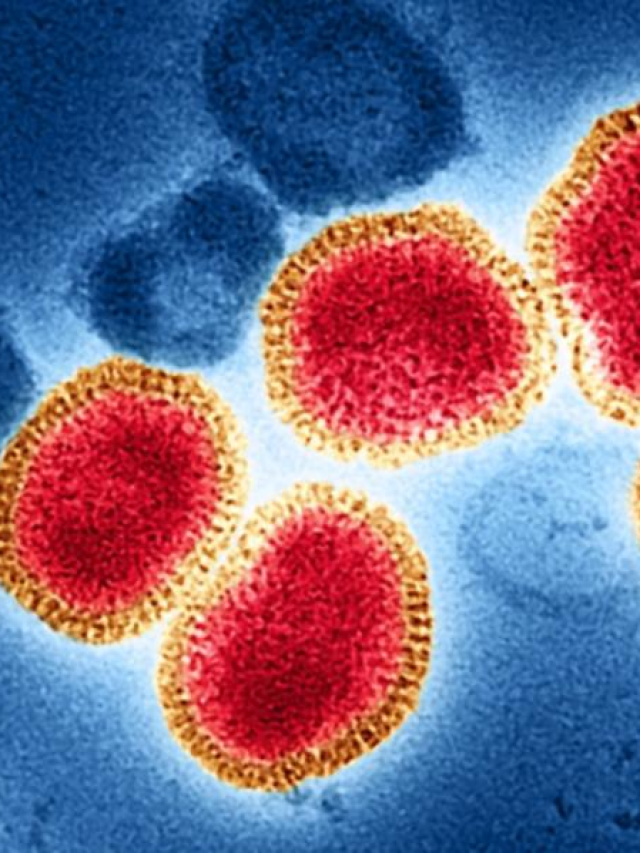 H3N2 Virus : A brief overview - NORTHEAST NOW