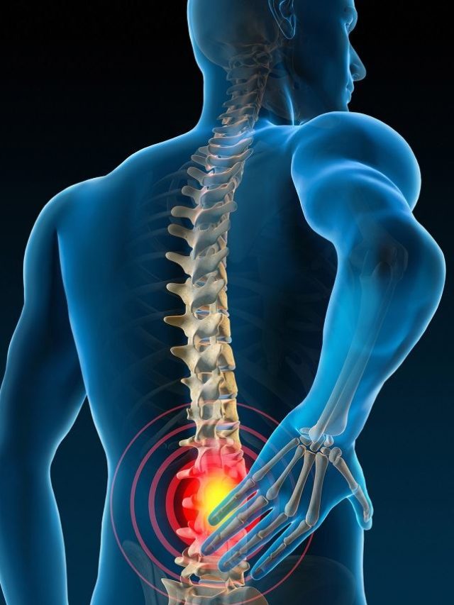 How To Prevent Back Pain - NORTHEAST NOW